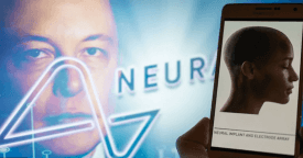 TMGM官网：埃隆·马斯克宣布首款 Neuralink 无线大脑芯片植入